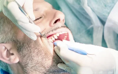 Getting to the Root of It: All About Root Canal