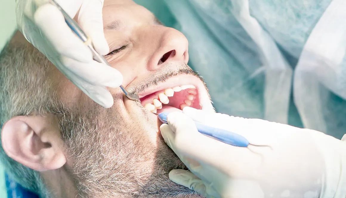 Root canal treatment
