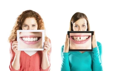 How Your Teeth Affect Your Self Esteem… And How to Improve Them