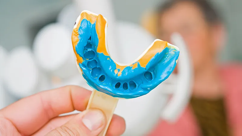 Dental Alignate Impression