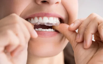Is clear aligner treatment right for your smile goals?