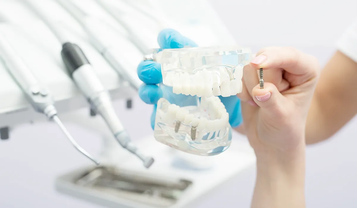 dental implant dental implant