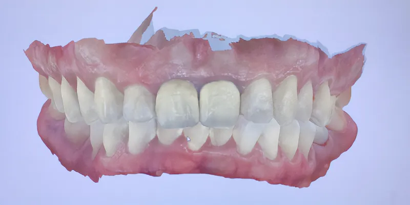 Diagnostic and digital planning