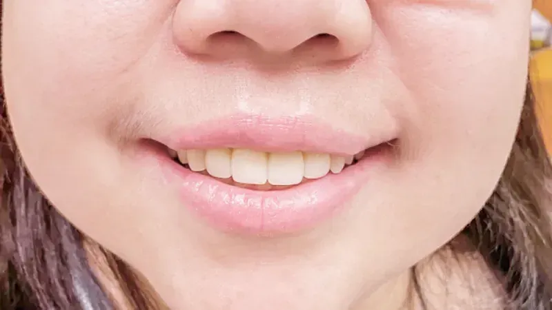 Restoring aesthetics