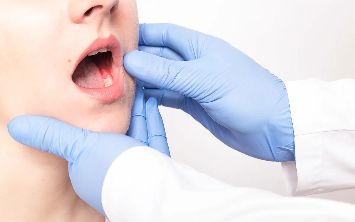 Gum disease