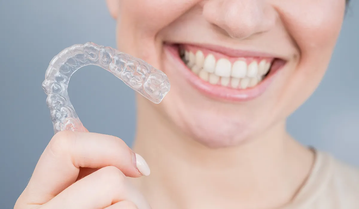 clear aligners